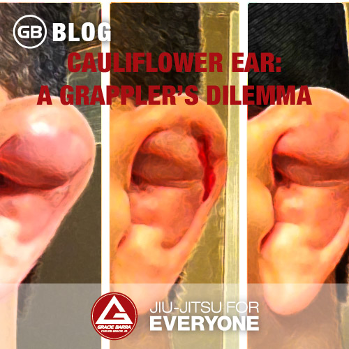 Cauliflower-Ear-A-Grappler%E2%80%99s-Dilemma-.jpg